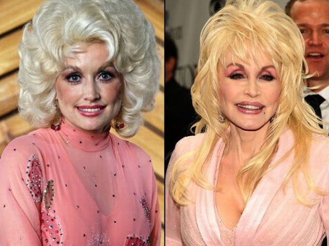 Dolly Parton Antes y Despues Dolly Parton Antes y Despues