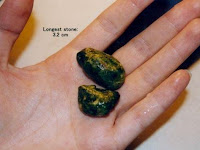 Pengobatan Batu empedu secara Tradisional (Herbal) Pengobatan Batu empedu secara Tradisional (Herbal)