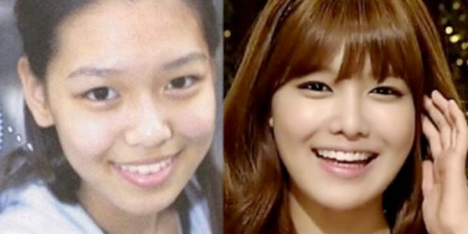 Sooyoung Girls' Perubahan Wajah Artis Korea