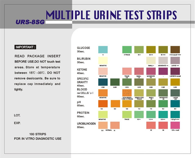 Urinalysis Test Color Chart