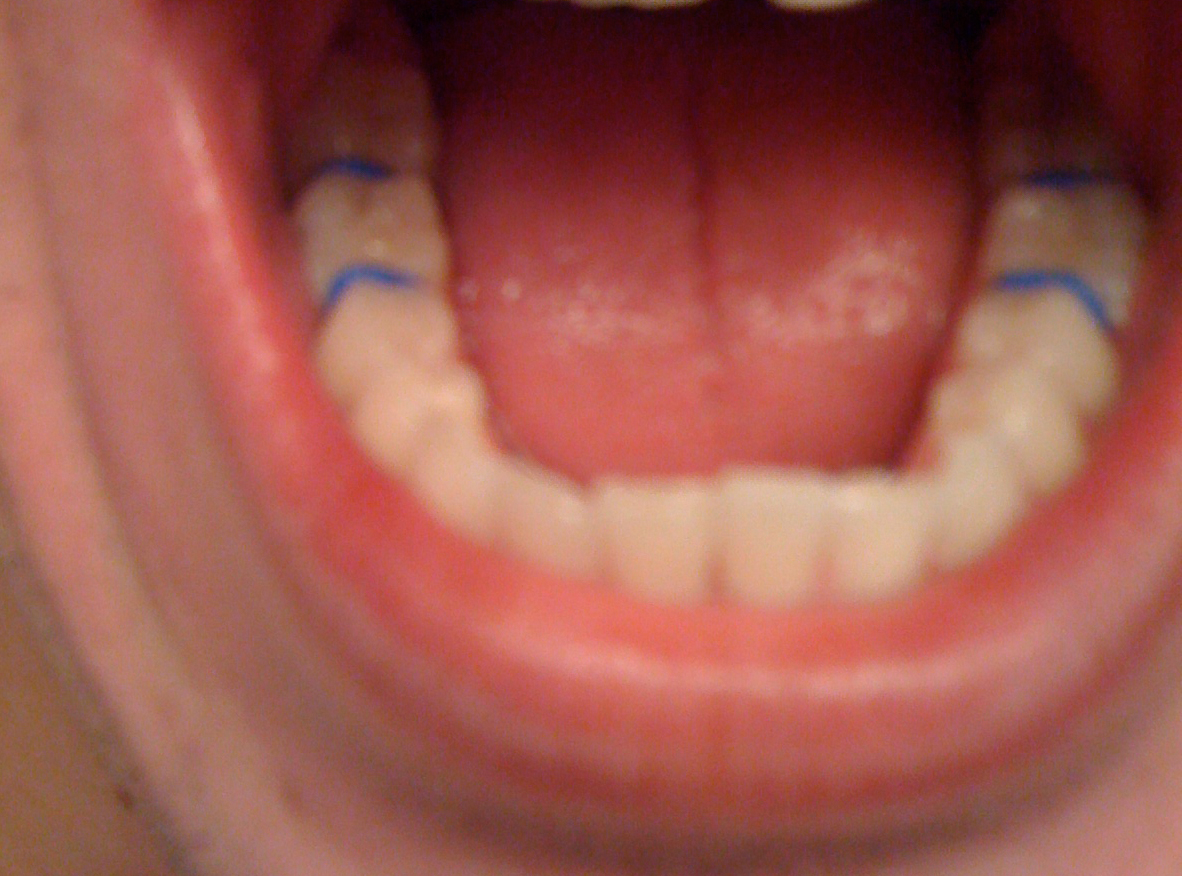 Extreme Makeover Tom Edition You've Got a Little Something Between