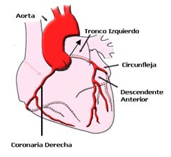 Arterias coronarias