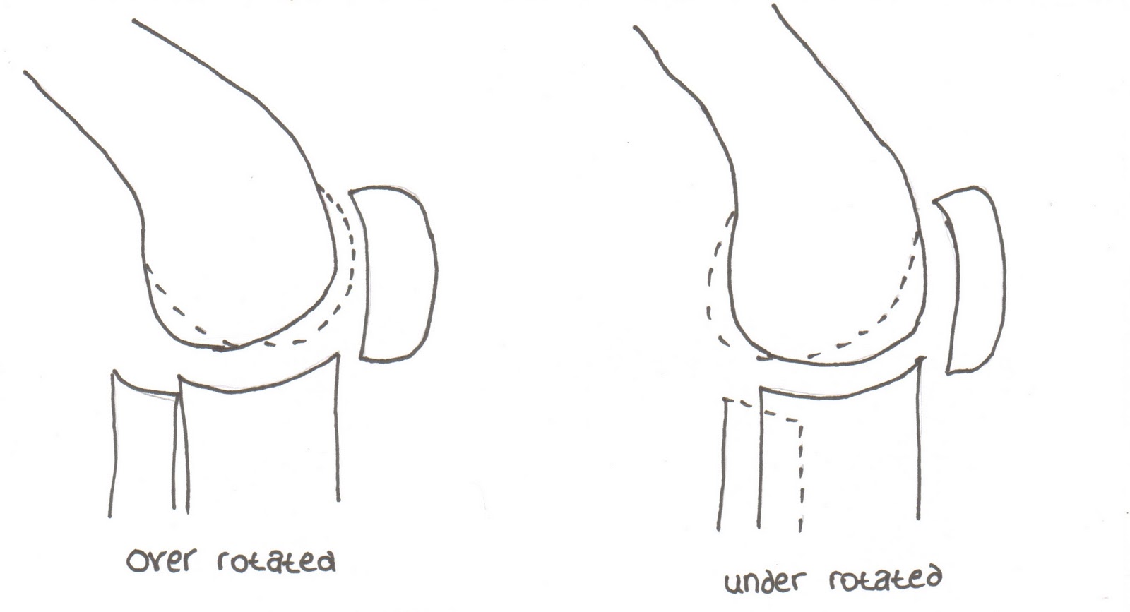 XRay Vision A Radiography Blog Lateral Knees How to fix them when