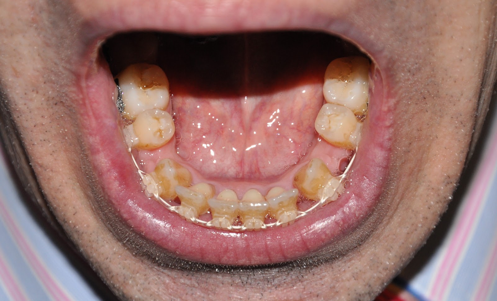 The View From My Soapbox June 2013