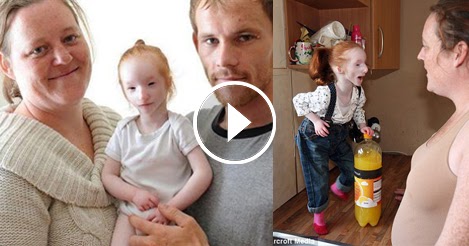 See World's Tiniest 5 Year Old Girl - Will Steal Your Heart