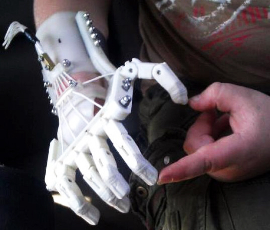 Protesis de mano humana