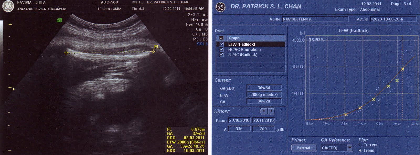 Letters to Wesley Jenssen 10th Ultrasound 36 Weeks