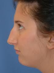 Long Nose Celebrities