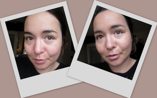 Before and After Photos with Dr Jart Water Fuse BB Cream Before and After Photos with Dr Jart Water Fuse BB Cream