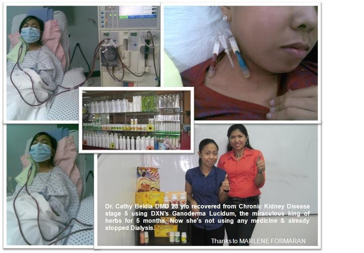 DXN Lingzhi Coffee Library Chronic Kidney Disease