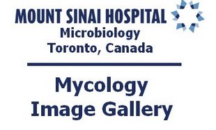 Mount Sinai Mycology