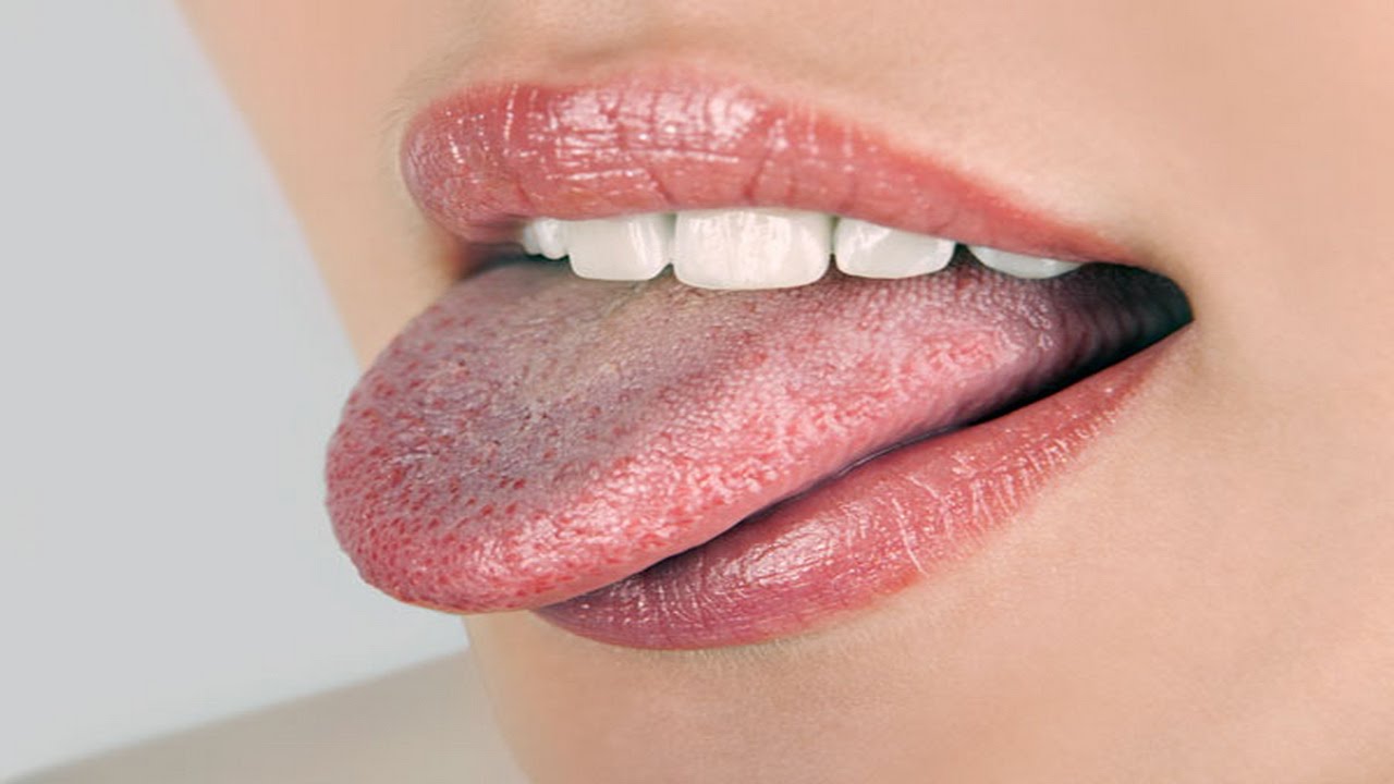 mancha rosa en la lengua