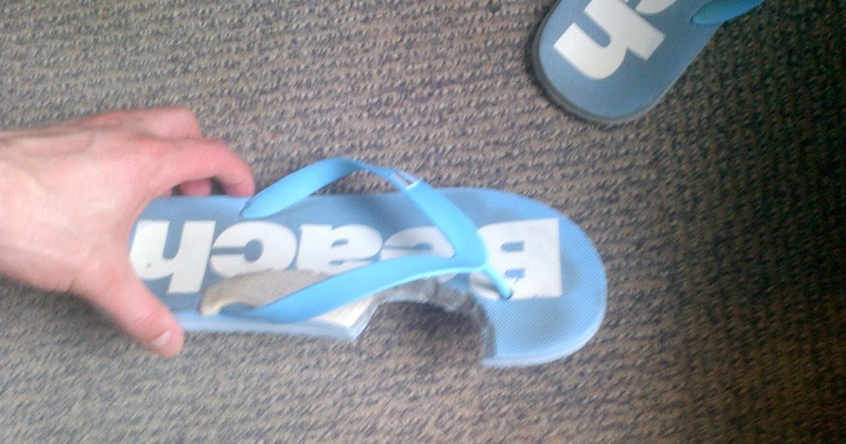 Foot and Ankle Problems By Dr. Richard Blake Sesamoid Injury Flip Flop Modification and Email