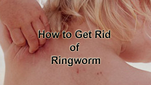 Ringworm comes from