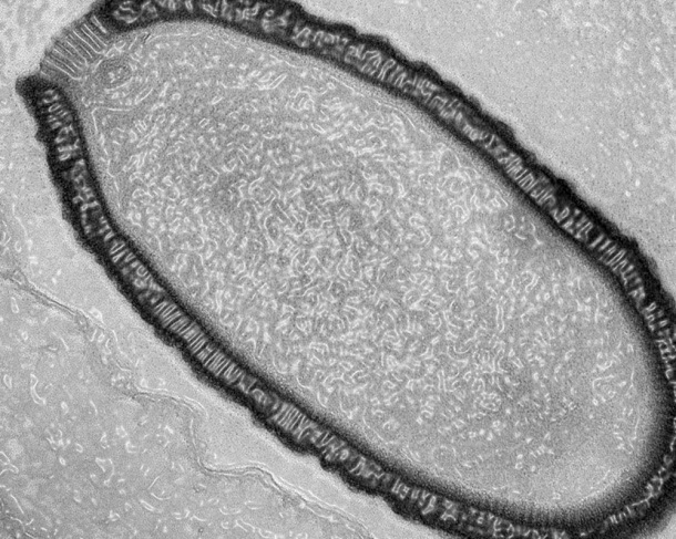Vírus gigante ressuscitado após 30.000 anos