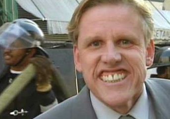 gary-busey_brain_injury.jpg