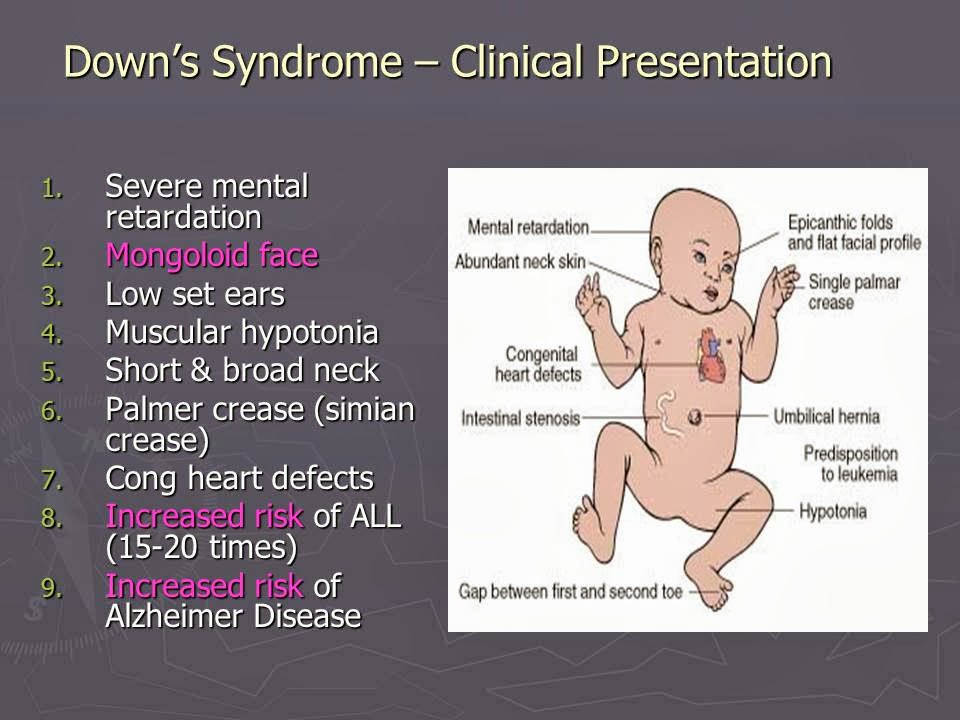 Slide 12