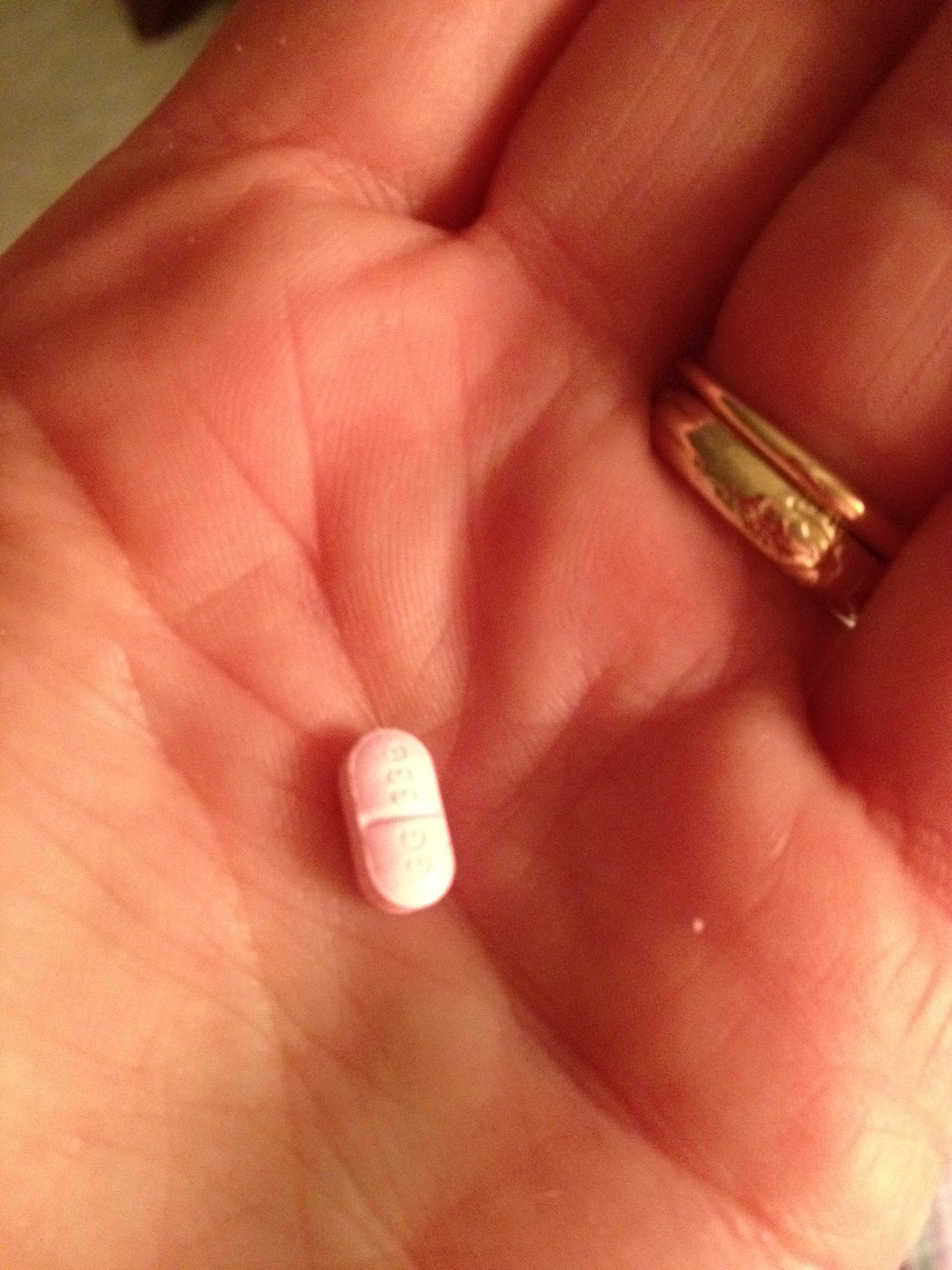 Radioactive Iodine Radioactive Iodine Pill