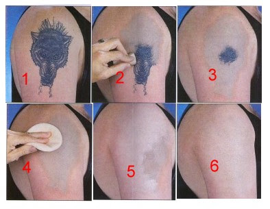 Tattoo Cover Up Techniques Tattoo Cover Up Techniques
