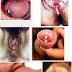 Obat Anti Gonore Pria dan Wanita thumbnail