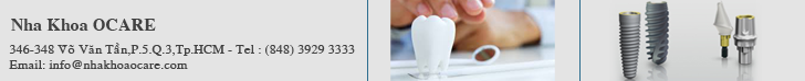 Răng sứ thẩm mỹ | Trồng răng giả | Cấy ghép Implant | Veneer Sứ