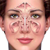 Cara Pengobatan Penyakit Sinusitis | Penyakit Sinusitis | Cara Mengatasi Dan Mengobati Penyakit Sinusitis