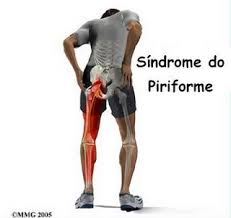  Conheça qual a causa da sua dor nas pernas e veja o melhor tratamento - CANSAÇO E DOR NAS PERNAS - QUAIS AS CAUSAS E COMO TRATAR - - Biguaçu, Palhoça, Antonio Carlos SC, Tijucas, Santo Amaro da Imperatriz, Paulo Lopes SC, Florianópolis, São José SC - Gotas para sinusite Rinite, Jaraguá do Sul SC, Venda de Cone Chinês e Limpeza de Ouvidos, Vico Massagista Quiropraxia Acupuntura Massoterapia Massagem Relaxante Sueca Terapêutica Ventosaterapia Shiatsu Do-In Reflexologia, MASSAGEM PARA DORES NA COLUNA EM SÃO JOSÉ SC - VICO MASSAGISTA - (48) 3094-5746 - MASSOTERAPIA http://clinicamassagemterapeutica.com.br/2017/08/27/massagem-para-dores-na-coluna-em-sao-jose-sc-vico-massagista-massoterapia-quiropraxia-acupuntura/ AS DORES NA COLUNA, CAUSAS E ORIGENS Sentir dores nas costas, de vez em quando, é muito comum, ainda mais para quem trabalha sentado por muitas horas no dia. A coluna vertebral ou coluna dorsal é uma das maiores partes do corpo humano, pois ela começa no pescoço e vai até o Cóccix. Essa região pode sofrer lesões e dores constantes causadas por estresse, cansaço, esforço em excesso, tais como exercícios, longas jornadas de trabalho, carregar pesos como mochilas e bolsas, e má postura no dia a dia. Uma forma de resolver problemas de dores na coluna que causam dores nas costas e no pescoço, uma boa opção é fazer massagens. As massagens para coluna podem ser de diversos tipos (Massagem Terapêutica, Massoterapia, Reflexologia, Quiropraxia etc.) para resolver vários tipos de problemas e desconfortos.