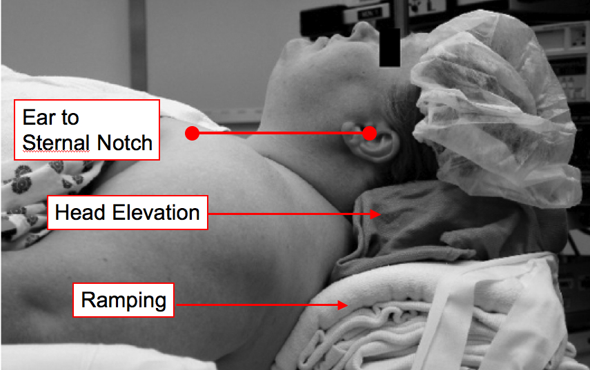 ANAESTHESIA TODAY 10 COMMON 'PROCEDURAL BASICS' ANAESTHESIOLOGISTS MAY OVERLOOK!