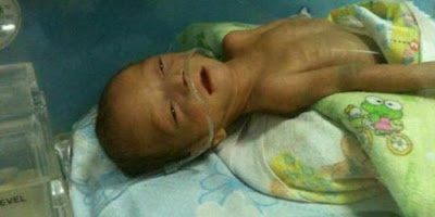Kisah seorang bayi meninggal karena ditolak RS di Jakarta