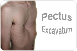 La vesícula biliar y la osteocondrosis el enlace