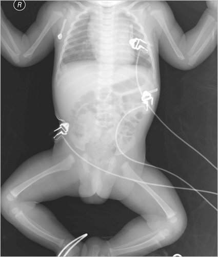 baby xray machine baby xray machine