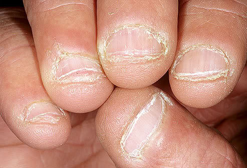 Why do people bite their nails?