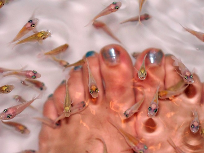 Fish Nibbling Feet