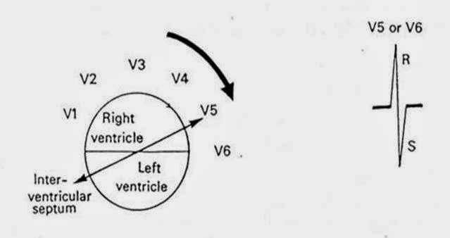 Dokter Medis Menentukan Sumbu Jantung Secara Cepat