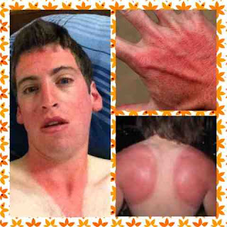 home remedies for tanning,home remedies for sunburn,home remedies for sunburn and tanning,home remedies to remove tanning,home remedies to remove sunburn,home remedies to remove tanning and sunburn,home remedies to get rid of tanning,home remedies to get rid of sunburn,home remedies to get rid of tanning and sunburn,home remedies to get rid of sunburn and tanning,how to get rid of tanning,how to get rid of sunburn,hiw to get rid of tanning and sunburn,how to remove tanning,how to remove sunburn,how to get rid of tanning fast,how to get rid of sunburn fast,how to remove tanning fast,how to remove sunburn fast,how to remove tanning from body,how to remove tanning from bady fast,how to remove sunburn fast,how to remove sunburn on body fast,how to remove tanning from face,how to remove tanning from face,how to remove sunburn from face fast,how to remove sunburn from bady fast,home remedies to get fair,home remedies to get fair fast,home remedies to become fair,home remedies to become fair fast,easy home remedies to remove tanning,easy home remedies to remove sunburn,how to treat sunburn,how to treat tanning,home remedies to treat tanning,home remefies to treat sunburn,indian home remedies,indian home remedies to remove tanning,indian home remedies to remove sunburn,home remedies,indian home remedies,home remedies blog,indian home remedies nlof,indian beauty blog,