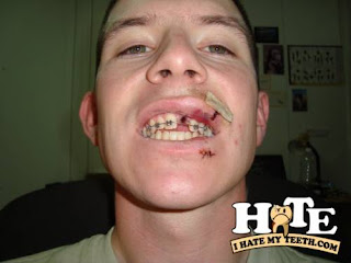 funny wisdom teeth quotes - ONLINE NEWS ICON