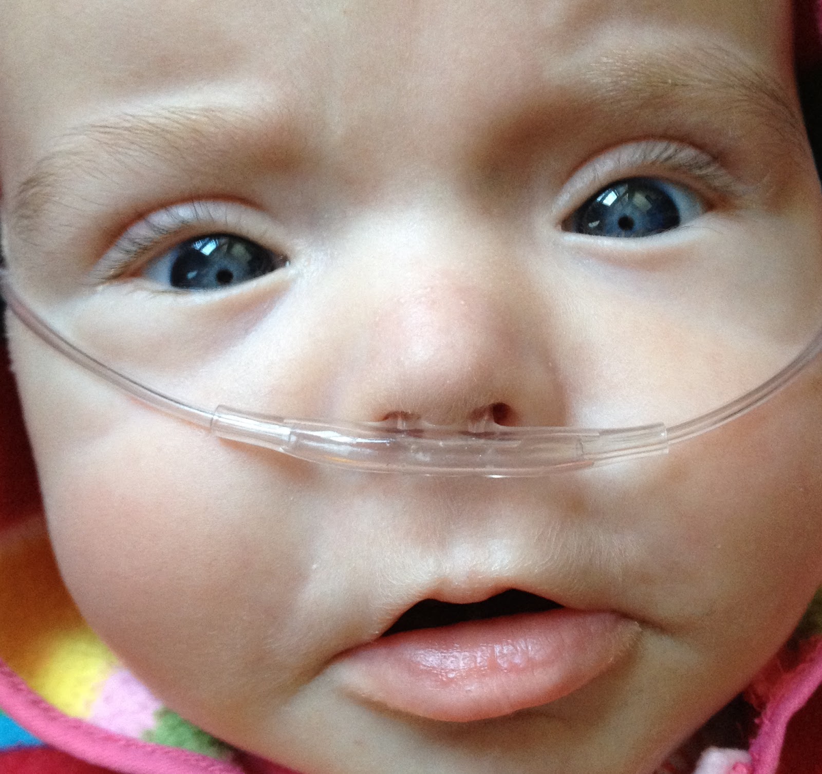 Worlds Prettiest Eyes