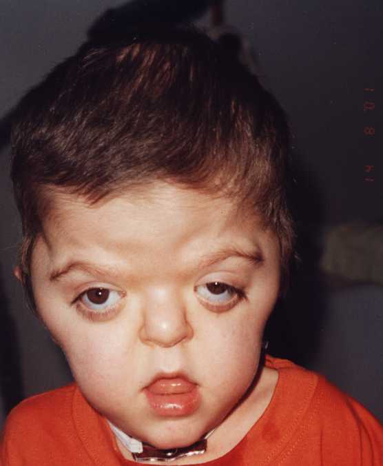 Download Growing Up Fisher Season 1 Episodes 1337x