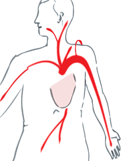 angina pectoris pain