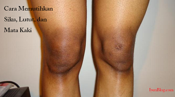 4 Cara Alami Menghilangkan Warna Hitam Pada Siku Lutut Dan Mata Kaki Iyenblog Com