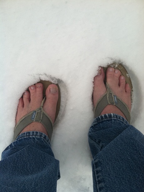 people with webbed feet people with webbed feet