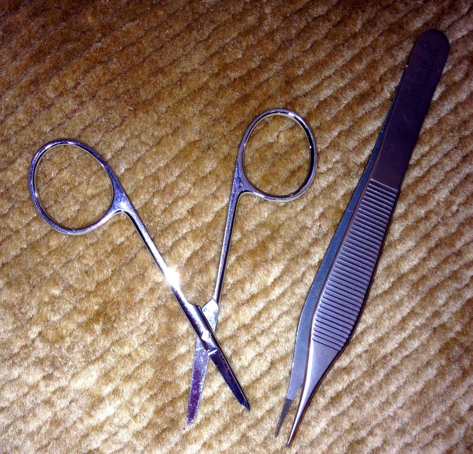 After LisFranc Surgery Lisfranc hardware removal 2 weeks post op