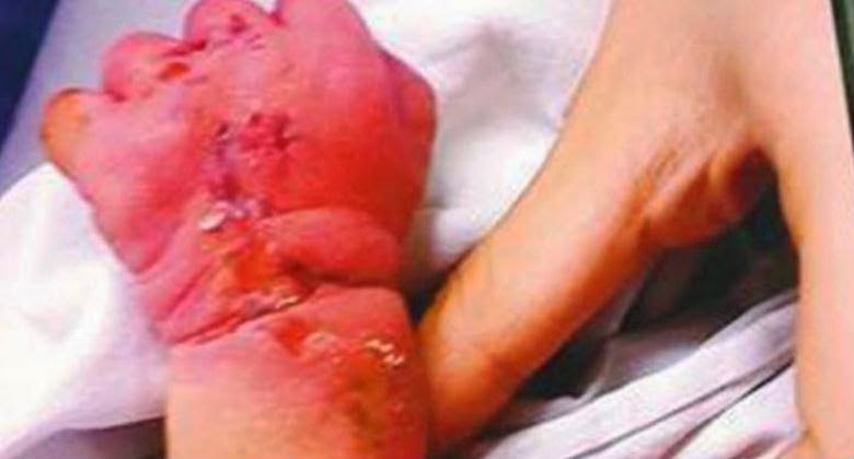 Seorang Ibu yang Baru Melahirkan Ingin Memakan Bayinya