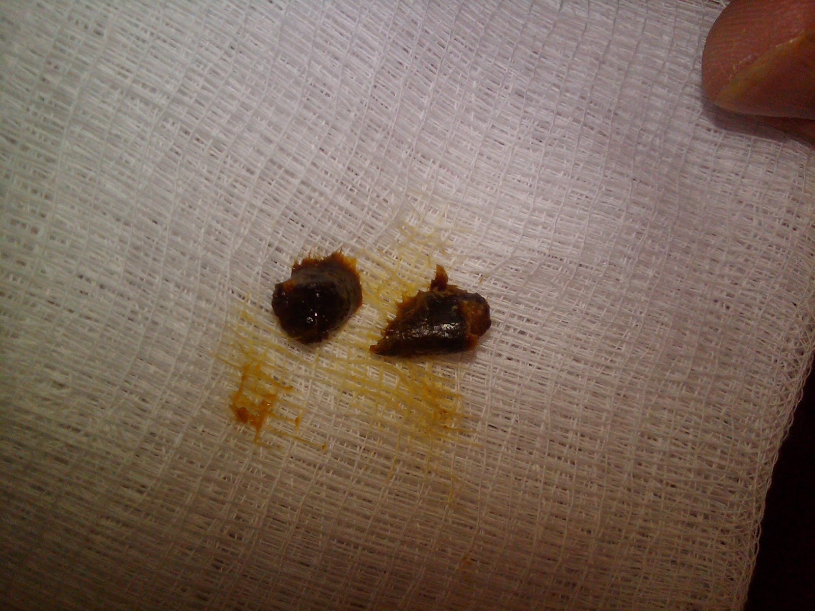 WARNING!!! QTips are not for Ear Cleaning!!! Joe's Barbell