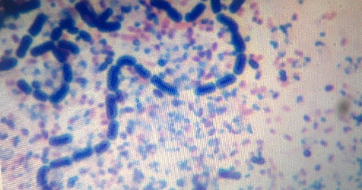 AMP Blog OBSERVACIÓN DE BACTERIAS DEL YOGUR