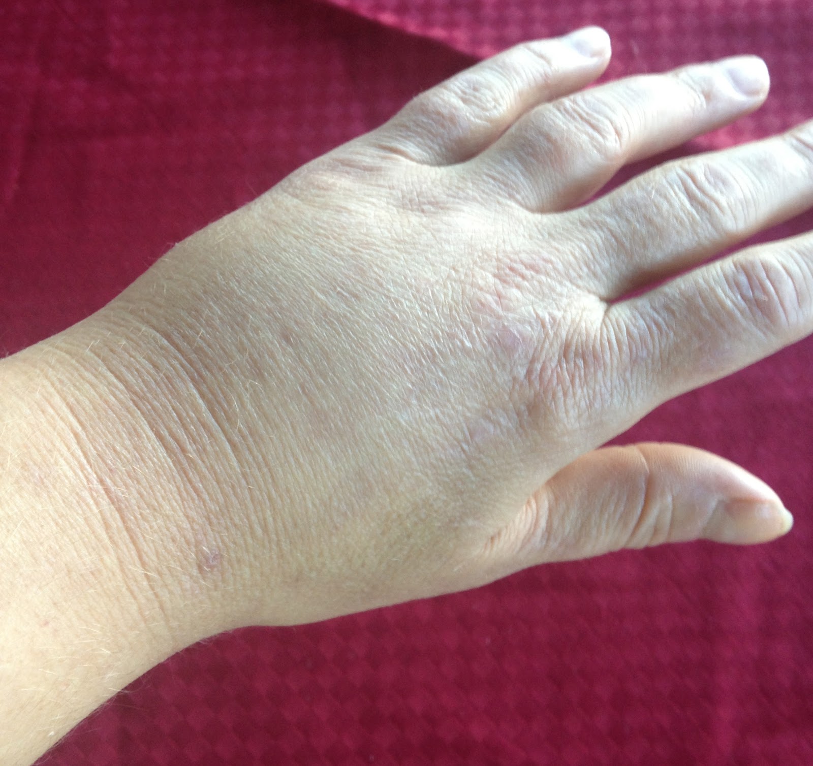 Laughing All the Way... Through Chronic Illness Feeling Hot, Hot, Hot