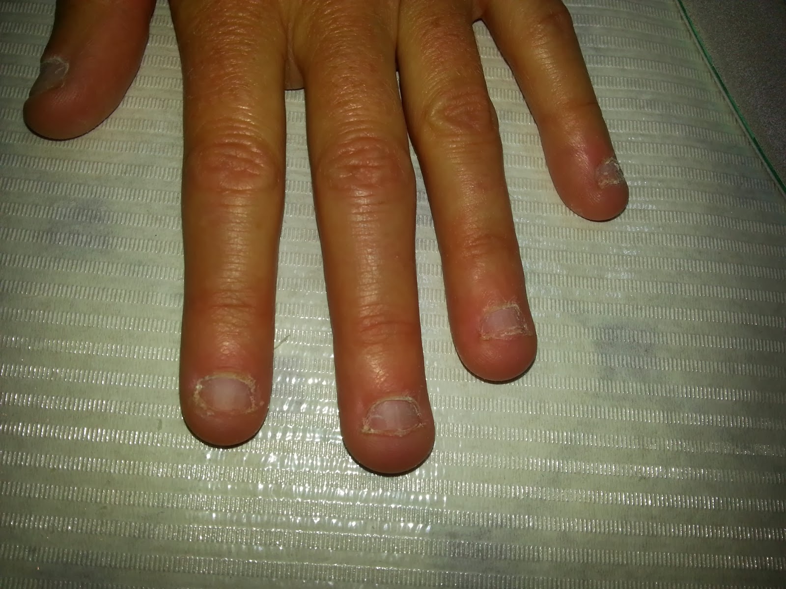 Beauty Griff's Ongles Rongés