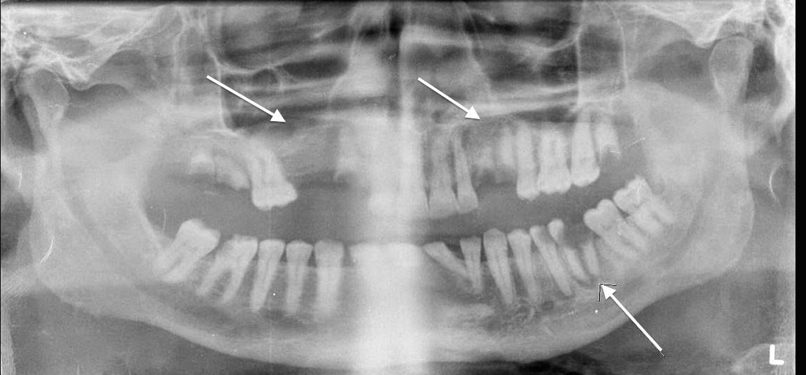 Cases and Images in Infectious Disease: December 2014