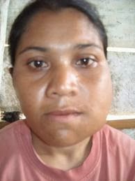 Cara Tradisional Sembuhkan Penyakit Tumor Rahang Cara Tradisional Sembuhkan Penyakit Tumor Rahang