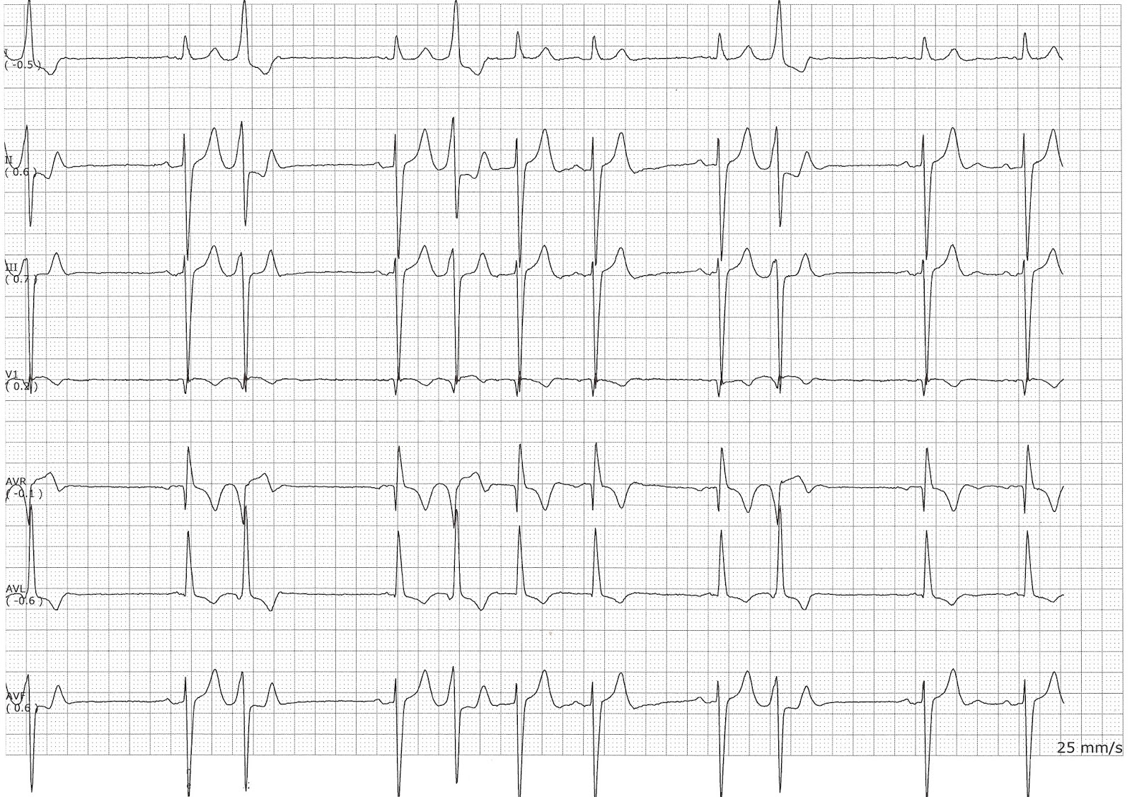 ekg practice questions Nclex ekg practice questions 1 2 3 related searches for ekg practice for nclex ekg strips for the nclex & beginners ekg practice for nclex - bing. ekg practice questions Nclex ekg practice questions 1 2 3 related searches for ekg practice for nclex ekg strips for the nclex & beginners ekg practice for nclex - bing.